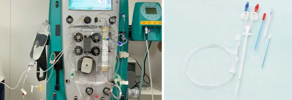 adequacy-testing-for-dialysis