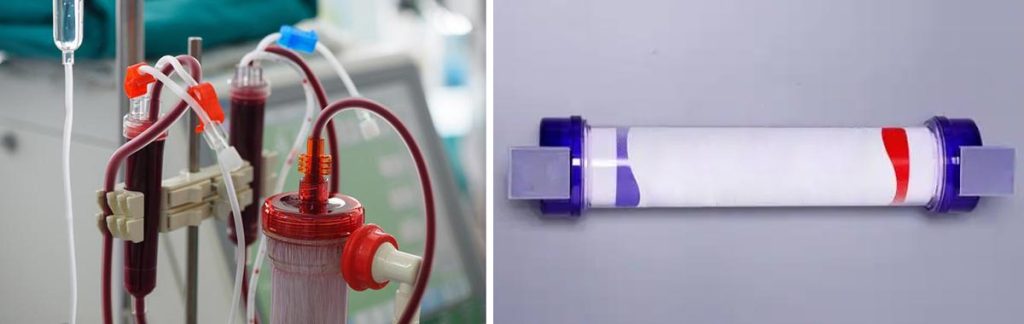 advanced-smart-dialysis-equipment-solutions