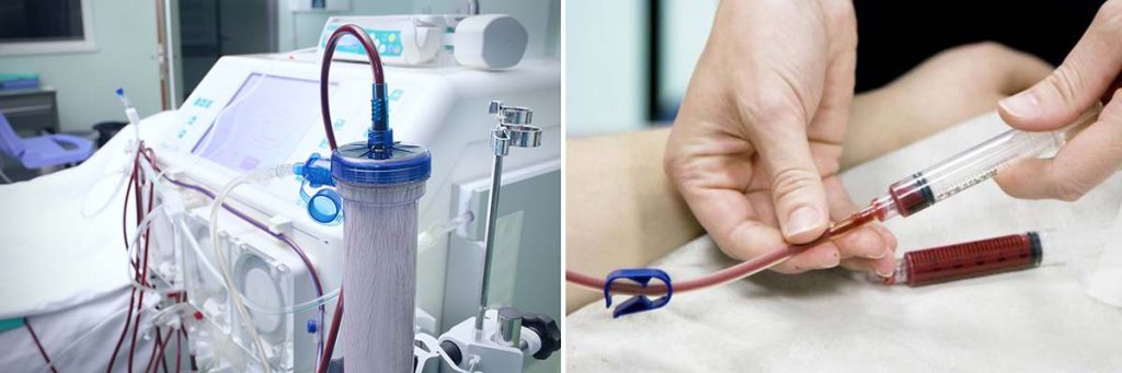 can-cancer-patients-undergo-dialysis