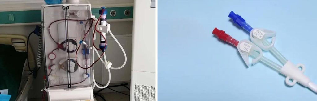 can-dialysis-centers-refuse-to-treat-a-patient