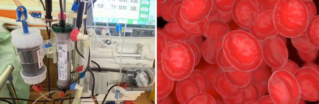 can-dialysis-centers-refuse-to-treat-patients