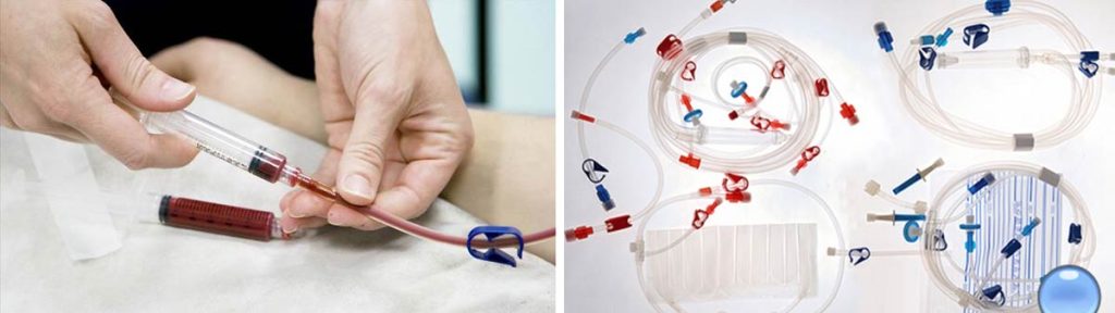 can-dialysis-support-cancer-patients