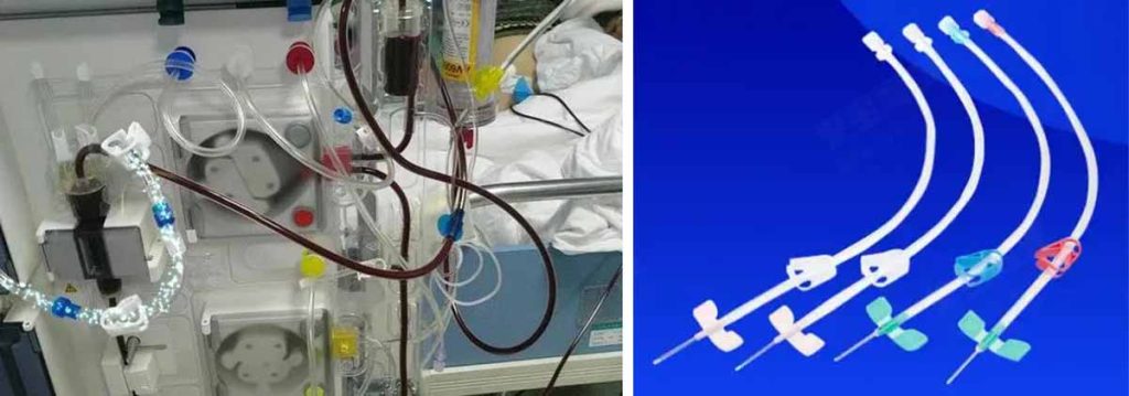 can-glucose-pass-through-a-dialysis-membrane