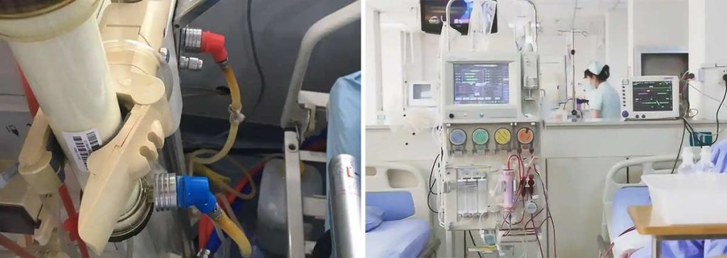 kidney-dialysis-and-oral-treatment