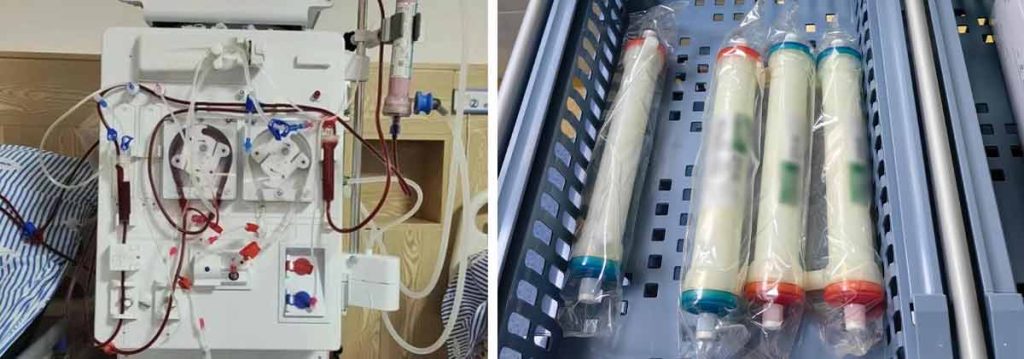 diabetes-and-peritoneal-dialysis