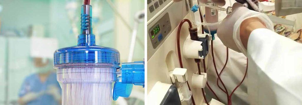 dialysis-and-dental-treatment