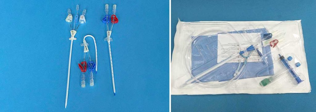 dialysis-ports-types