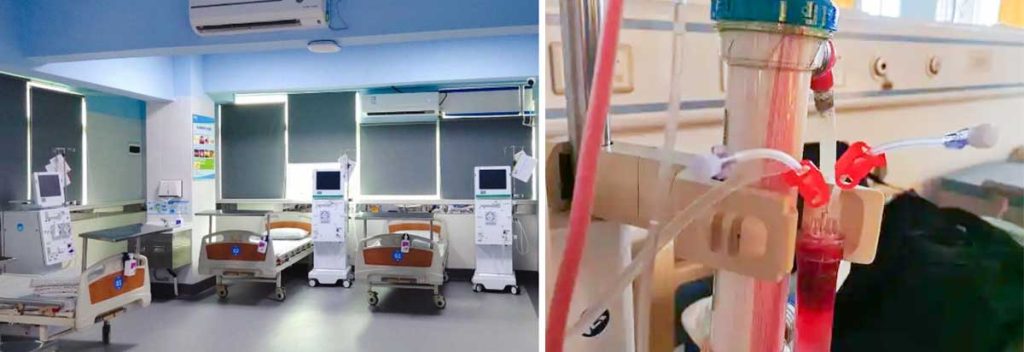 diarrhea-during-dialysis