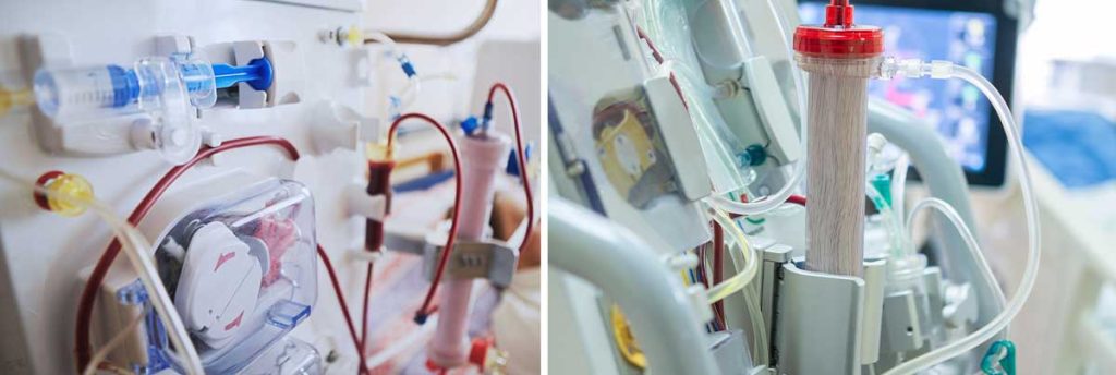 diarrhea-in-dialysis