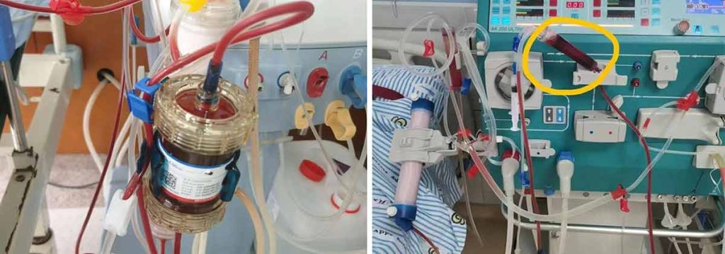 difference-between-osmosis-and-dialysis