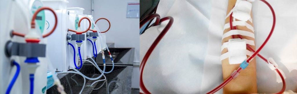 disinfectant-used-in-dialysis