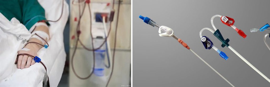 does-medicaid-pay-for-dialysis-treatments