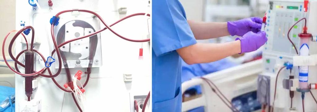 does-peritoneal-dialysis-remove-phosphorus-as-effectively-as-hemodialysis