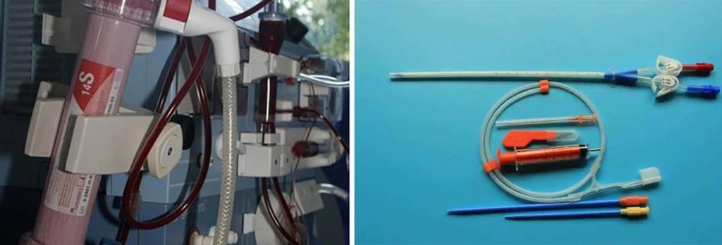 free-transportation-for-dialysis-patients