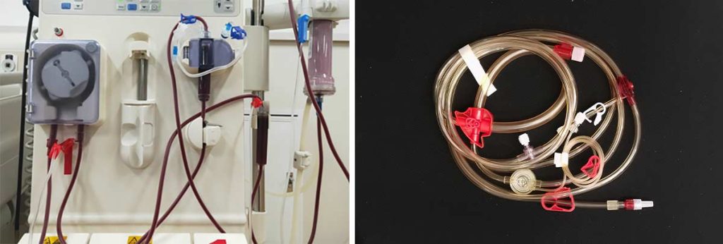 glucose-pass-through-a-dialysis-membrane