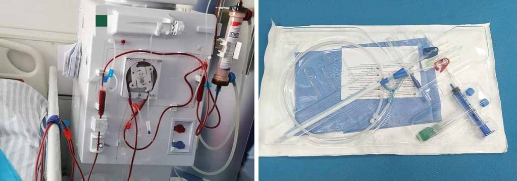 have-dialysis-2-days-in-a-row