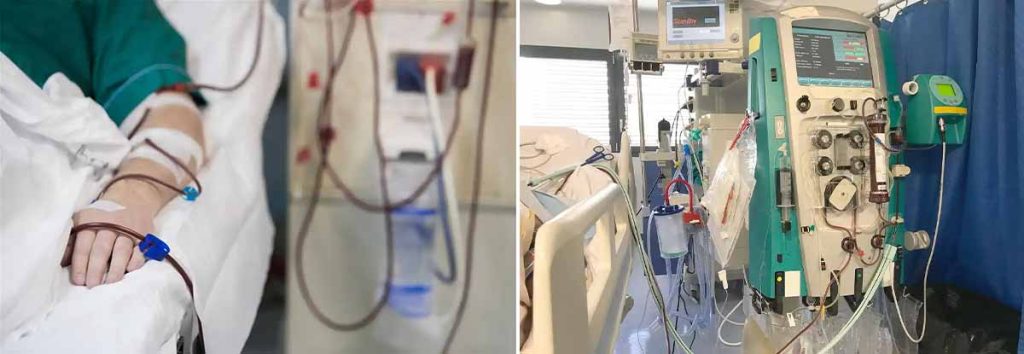 high-level-disinfectant-used-during-dialysis