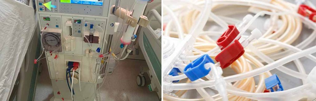 how-to-avoid-clotting-during-dialysis