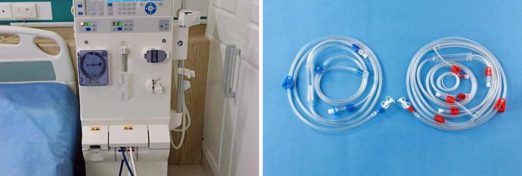 is-4.5-creatinine-level-needed-for-hemodialysis