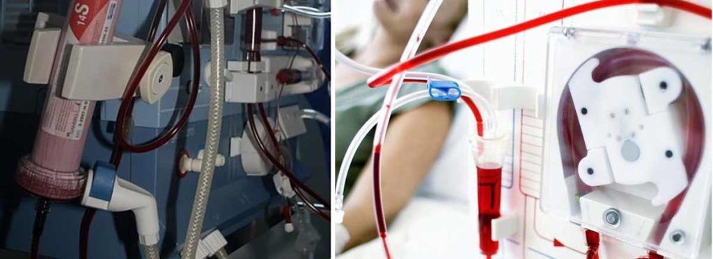 is-there-free-transportation-for-dialysis-patients
