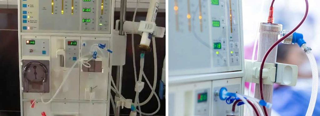 lower-back-pain-in-dialysis-patients