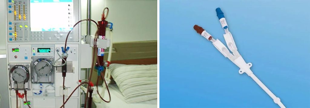 prevent-leg-cramps-after-dialysis