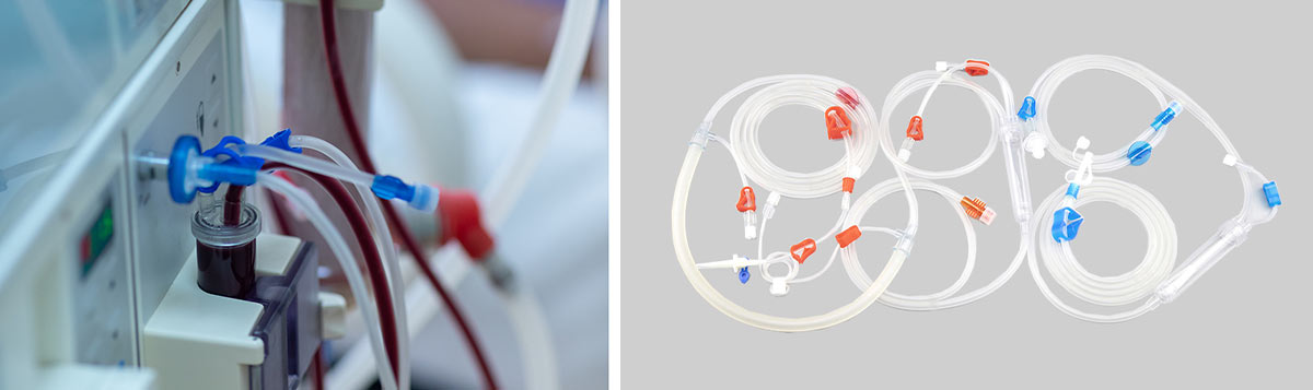 Understanding the Causes of Low TMP in Dialysis: A Comprehensive Guide ...