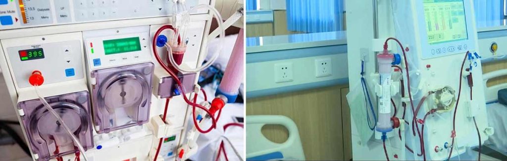 the-role-of-osmosis-in-the-dialysis-process