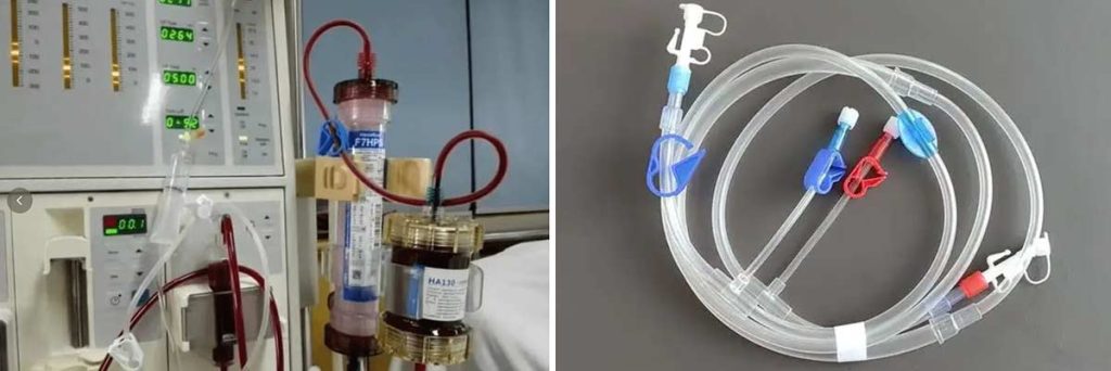 water-intake-for-patients-undergoing-dialysis