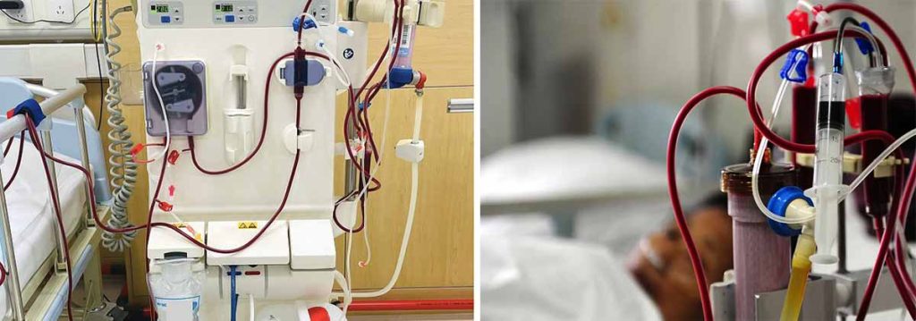 what-are-good-snacks-for-dialysis-patients