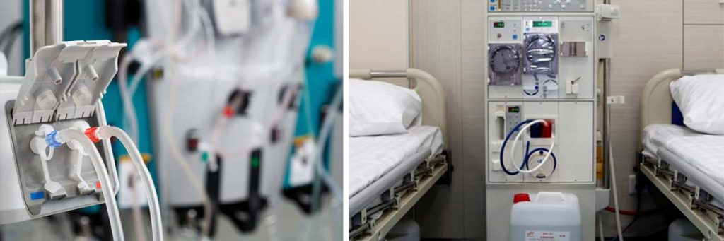 what-causes-blood-clotting-during-dialysis