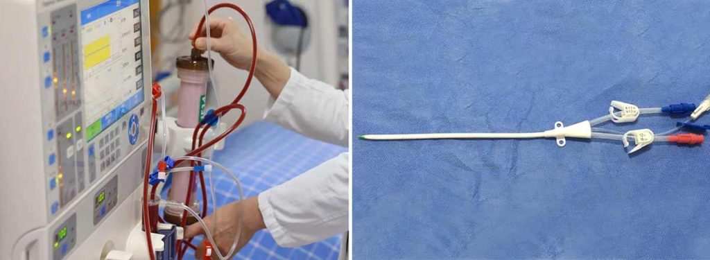 what-happens-if-you-only-do-dialysis-twice-a-week
