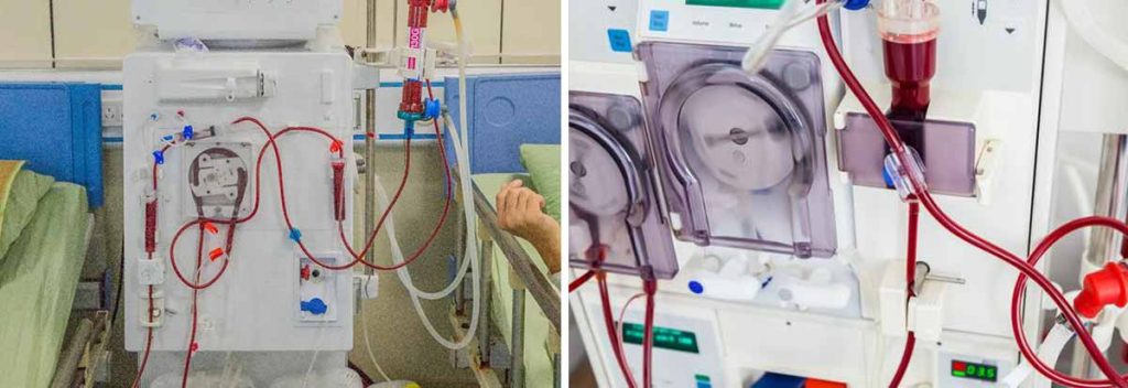 what-high-level-disinfectant-is-used-in-dialysis