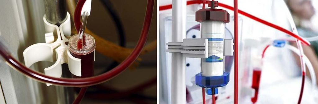 what-is-normal-blood-pressure-for-dialysis-patient