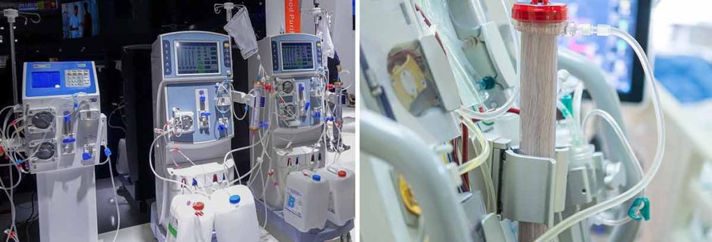 when-is-it-too-late-to-start-dialysis