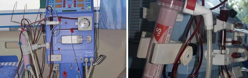 work-while-on-dialysis