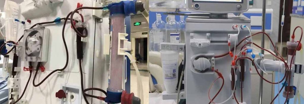 blood-flow-rate-of-dialysis