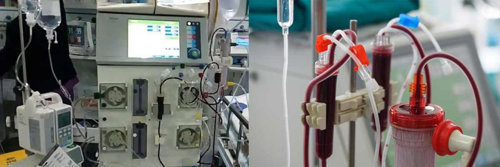 can-dialysis-patients-urinate