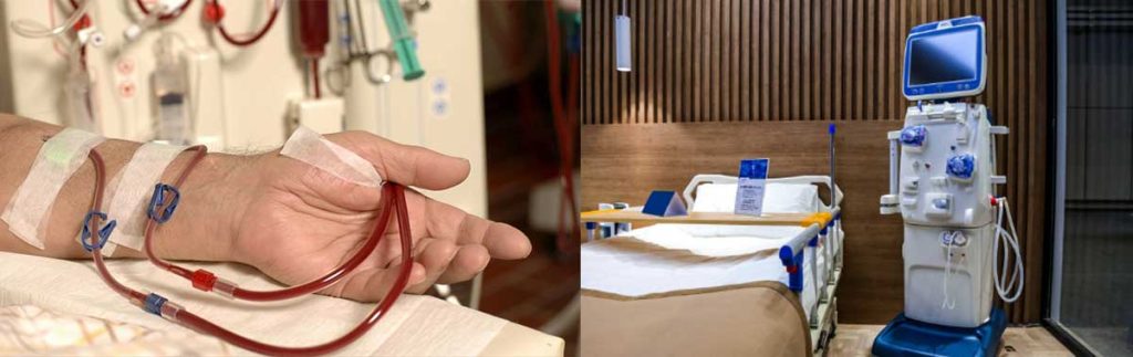 cramping-during-dialysis