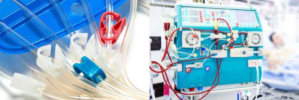 cramps-during-dialysis