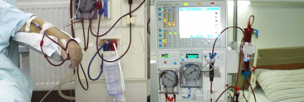 dialysis-equipment-supplier