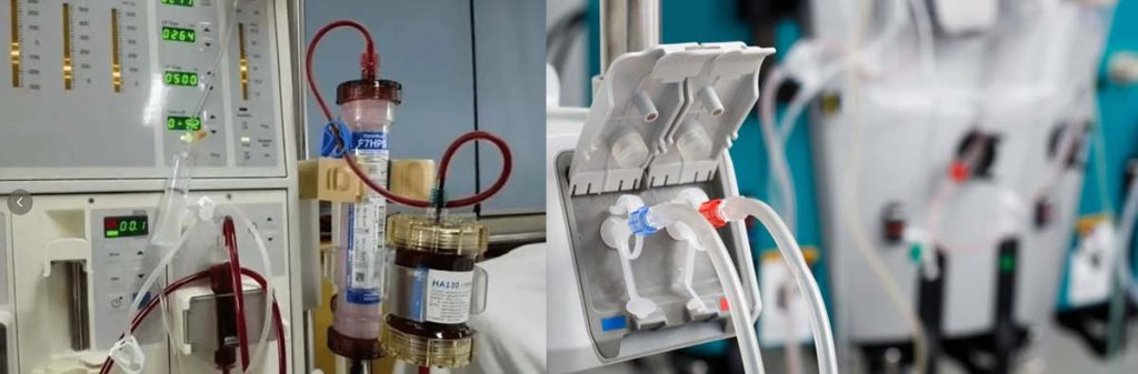 dialysis-equipment-suppliers