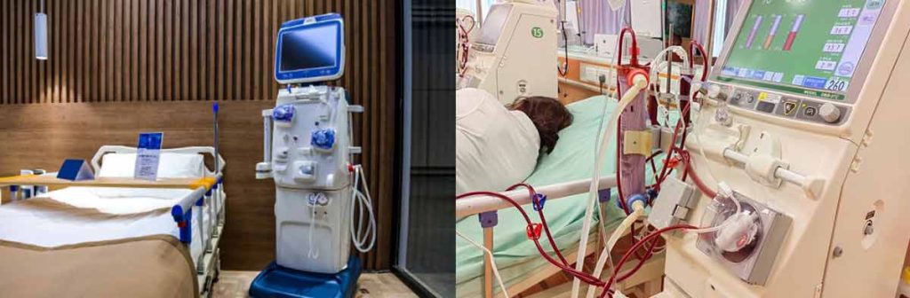dialysis-filtration