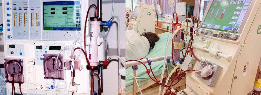 dialysis-fistula-types