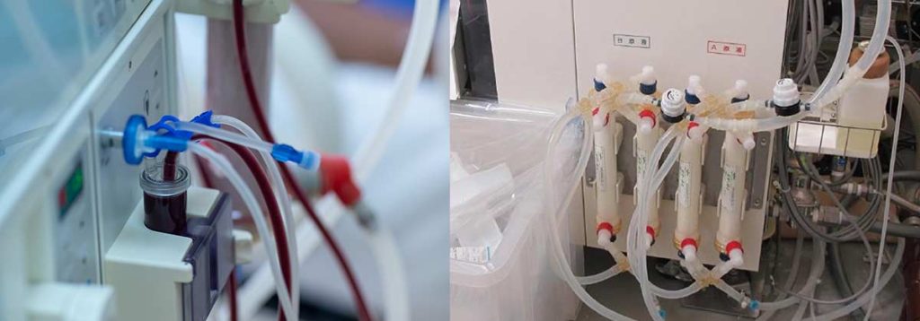 dialysis-water-treatment-systems