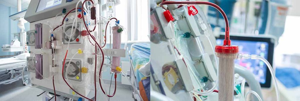 hemodialysis-and-hemoglobin