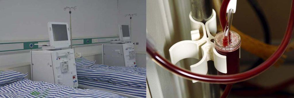 hemodialysis-filtration