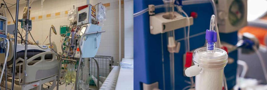 infection-of-dialysis