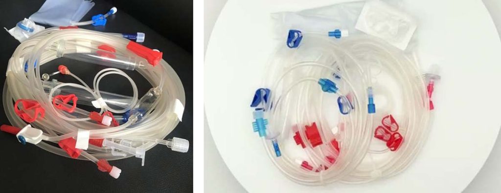 muscle-cramps-after-dialysis