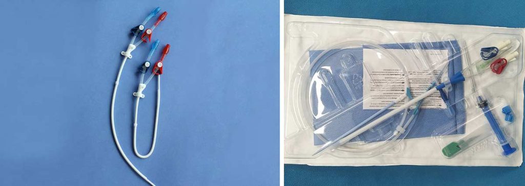 peritoneal-dialysis-catheter-types